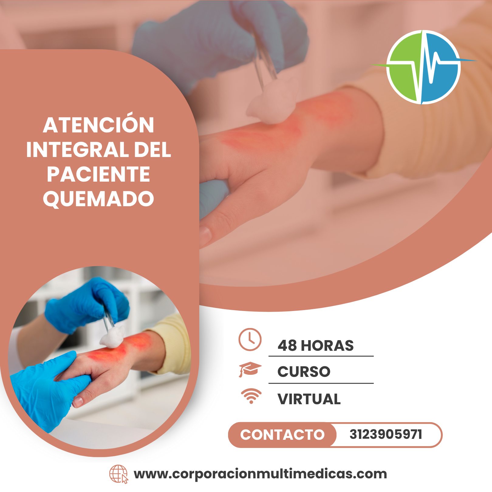 PACIENTE QUEMADO