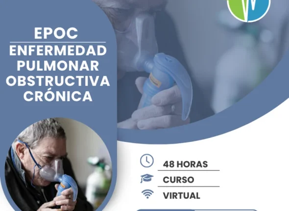 EPOC